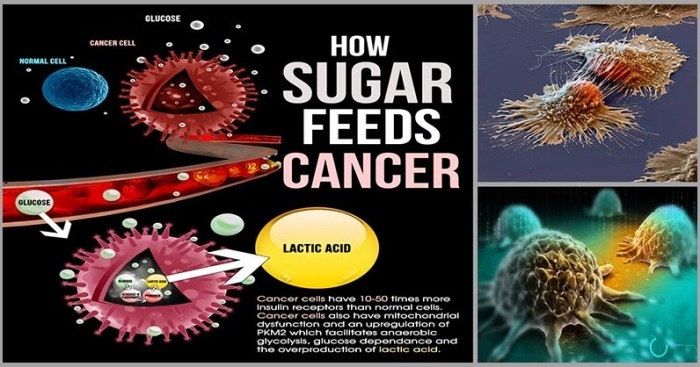 Sugar Doesn't Just Feed Cancer Cells, It Produces Them - Dr. Farrah MD